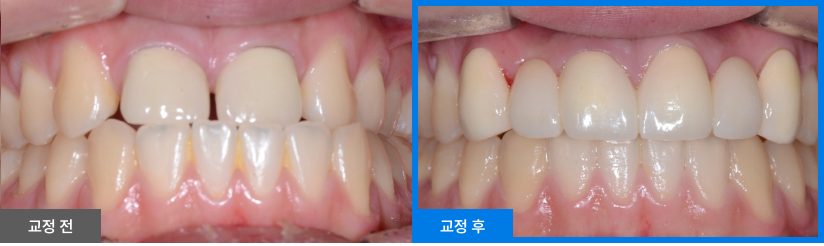 스케일링