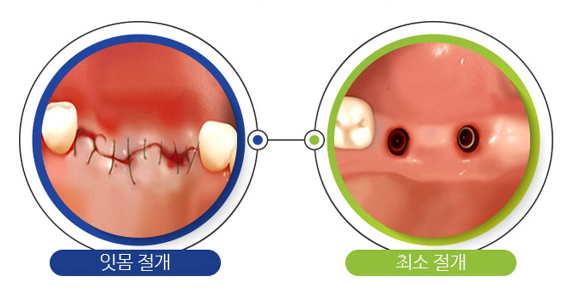 2D 3D 촬영 비교 이미지